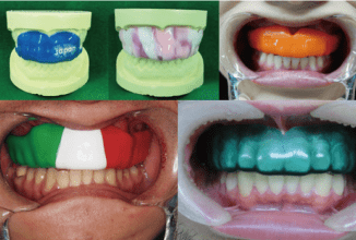 スポーツ歯科医学 スポーツマウスガード作製講習会
