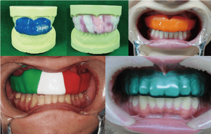 スポーツ歯科医学 スポーツマウスガード作製講習会