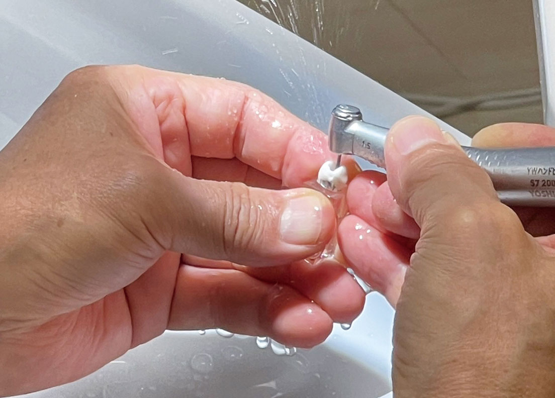 マルチディシプリナリーアプローチ (歯内療法コース) 平井先生