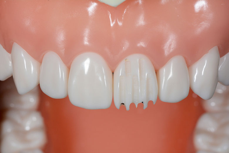 スタートアップ形成時のポジショニング、姿勢