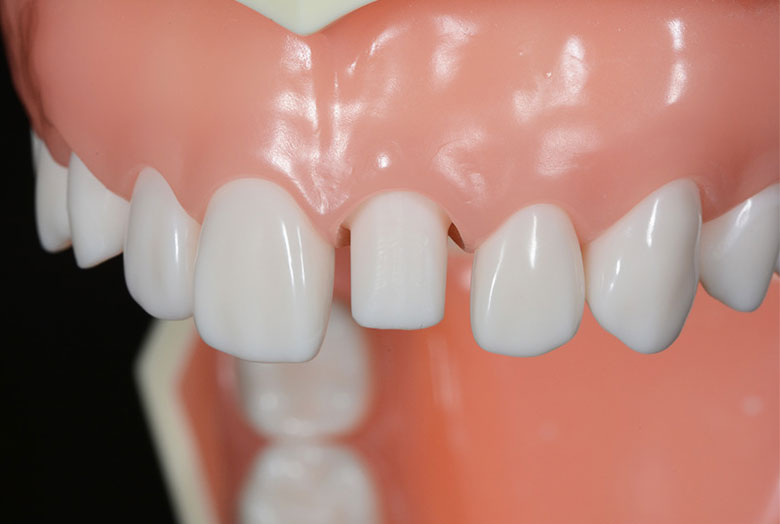 スタートアップ 形成時のポジショニング、姿勢