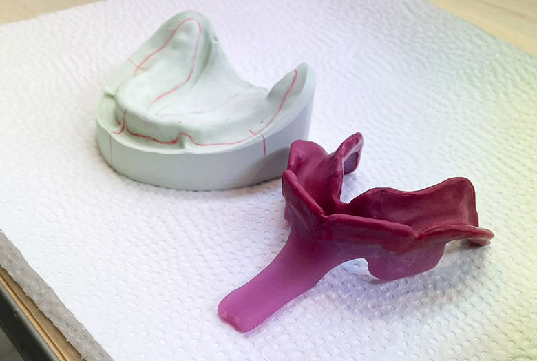 デモンストレーション全部床義歯補綴臨床の基本マスター 上濱先生